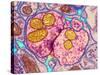 Synapse Nerve Junction, TEM-Thomas Deerinck-Stretched Canvas