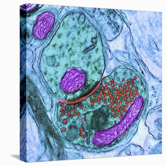 Synapse Nerve Junction, TEM-Thomas Deerinck-Stretched Canvas