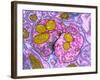 Synapse Nerve Junction, TEM-Thomas Deerinck-Framed Photographic Print