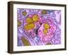 Synapse Nerve Junction, TEM-Thomas Deerinck-Framed Photographic Print