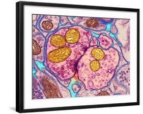 Synapse Nerve Junction, TEM-Thomas Deerinck-Framed Photographic Print