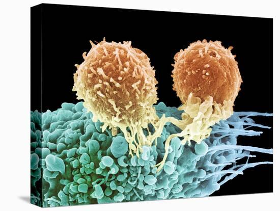 T Lymphocytes And Cancer Cell, SEM-Steve Gschmeissner-Stretched Canvas