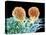 T Lymphocytes And Cancer Cell, SEM-Steve Gschmeissner-Stretched Canvas