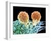 T Lymphocytes And Cancer Cell, SEM-Steve Gschmeissner-Framed Photographic Print
