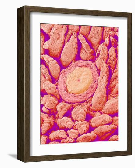 Taste bud cell and tongue filiform papillae of a rabbit magnified x300-Micro Discovery-Framed Photographic Print