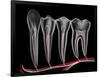 Teeth, Cross Section-PASIEKA-Framed Photographic Print