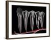 Teeth, Cross Section-PASIEKA-Framed Photographic Print