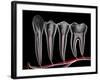 Teeth, Cross Section-PASIEKA-Framed Photographic Print