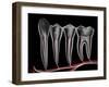 Teeth, Cross Section-PASIEKA-Framed Photographic Print