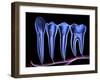 Teeth, Cross Section-PASIEKA-Framed Photographic Print