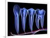 Teeth, Cross Section-PASIEKA-Framed Photographic Print