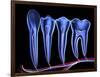 Teeth, Cross Section-PASIEKA-Framed Photographic Print