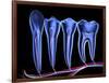 Teeth, Cross Section-PASIEKA-Framed Photographic Print