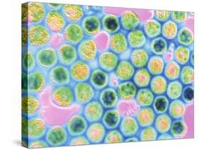 TEM Herpes Simplex Virus-null-Stretched Canvas