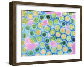 TEM Herpes Simplex Virus-null-Framed Photographic Print