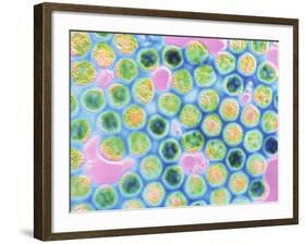 TEM Herpes Simplex Virus-null-Framed Photographic Print