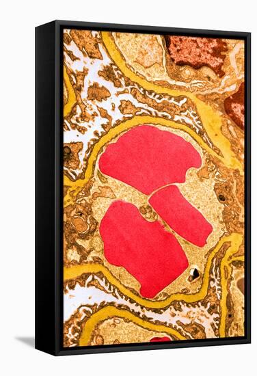 TEM of Glomerulus Capillary Loop-Science Source-Framed Stretched Canvas