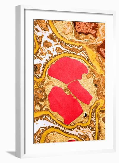 TEM of Glomerulus Capillary Loop-Science Source-Framed Photographic Print