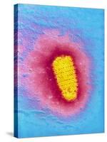 TEM of Rabies Virus-null-Stretched Canvas