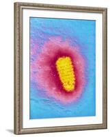 TEM of Rabies Virus-null-Framed Photographic Print