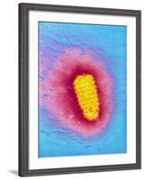 TEM of Rabies Virus-null-Framed Photographic Print