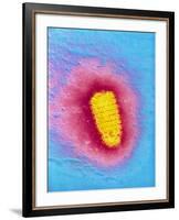 TEM of Rabies Virus-null-Framed Photographic Print