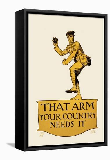 That Arm - Your Country Needs It-Vojtech Preissig-Framed Stretched Canvas