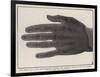 The Bones of a Hand Photographed Through the Flesh by Means of the New Process-null-Framed Giclee Print