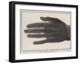 The Bones of a Hand Photographed Through the Flesh by Means of the New Process-null-Framed Giclee Print