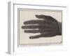 The Bones of a Hand Photographed Through the Flesh by Means of the New Process-null-Framed Giclee Print