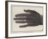 The Bones of a Hand Photographed Through the Flesh by Means of the New Process-null-Framed Giclee Print