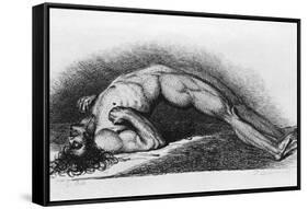The Contracted Body of Soldier Suffering from Tetanus-Charles Bell-Framed Stretched Canvas