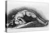 The Contracted Body of Soldier Suffering from Tetanus-Charles Bell-Stretched Canvas