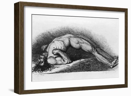 The Contracted Body of Soldier Suffering from Tetanus-Charles Bell-Framed Art Print