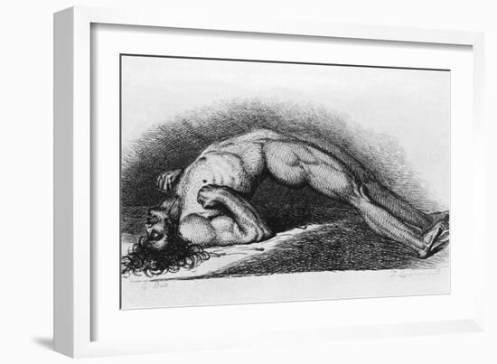 The Contracted Body of Soldier Suffering from Tetanus-Charles Bell-Framed Art Print