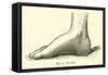 The Foot-Leveille-Framed Stretched Canvas