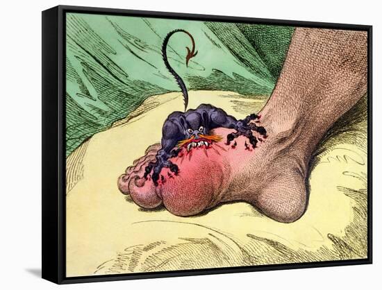 The Gout, Published by Hannah Humphrey in 1799-James Gillray-Framed Stretched Canvas