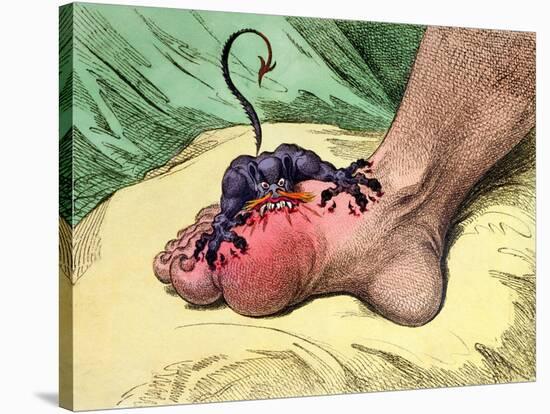 The Gout, Published by Hannah Humphrey in 1799-James Gillray-Stretched Canvas