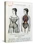 The Harmful Effects of the Corset, Illustration from "La Vie Normale Et La Sante"-null-Stretched Canvas
