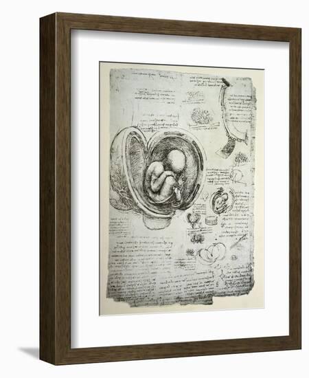 The Human Foetus in the Womb, Facsimile Copy-Leonardo da Vinci-Framed Premium Giclee Print