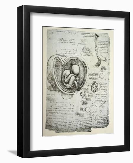 The Human Foetus in the Womb, Facsimile Copy-Leonardo da Vinci-Framed Premium Giclee Print