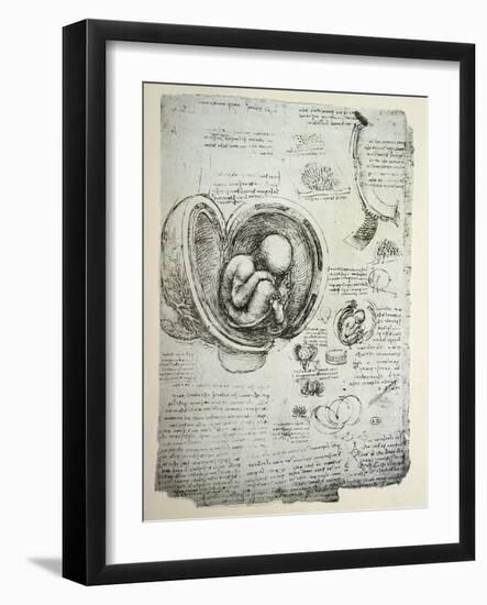 The Human Foetus in the Womb, Facsimile Copy-Leonardo da Vinci-Framed Giclee Print