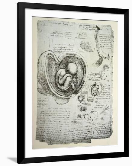 The Human Foetus in the Womb, Facsimile Copy-Leonardo da Vinci-Framed Giclee Print