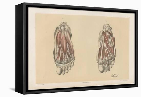 The Lower Limb. First and Second Stages in the Examination of the Sole of the Foot-G. H. Ford-Framed Stretched Canvas