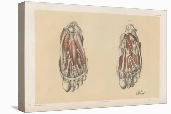 The Lower Limb. First and Second Stages in the Examination of the Sole of the Foot-G. H. Ford-Stretched Canvas