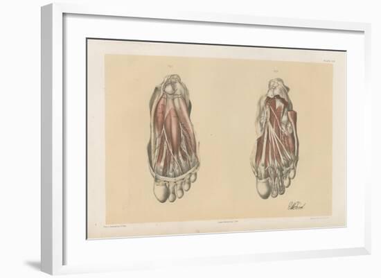 The Lower Limb. First and Second Stages in the Examination of the Sole of the Foot-G. H. Ford-Framed Giclee Print