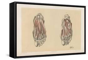 The Lower Limb. First and Second Stages in the Examination of the Sole of the Foot-G. H. Ford-Framed Stretched Canvas