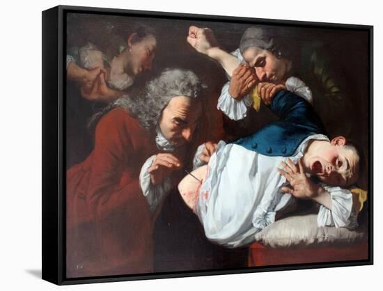 The Surgical Operation-Gaspare Traversi-Framed Stretched Canvas