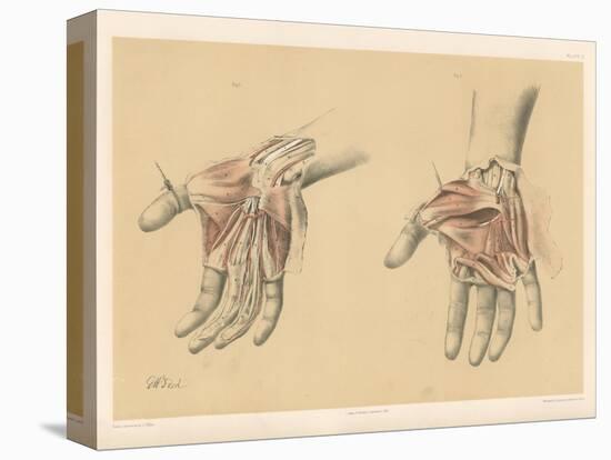 The Upper Limb. Superficial and Deep Views of the Palm of the Hand-G. H. Ford-Stretched Canvas