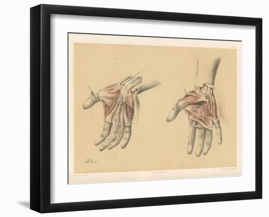 The Upper Limb. Superficial and Deep Views of the Palm of the Hand-G. H. Ford-Framed Giclee Print
